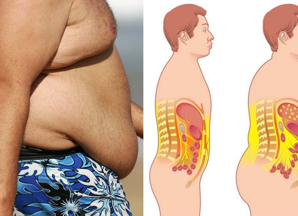 Почему у мужчин растет живот?