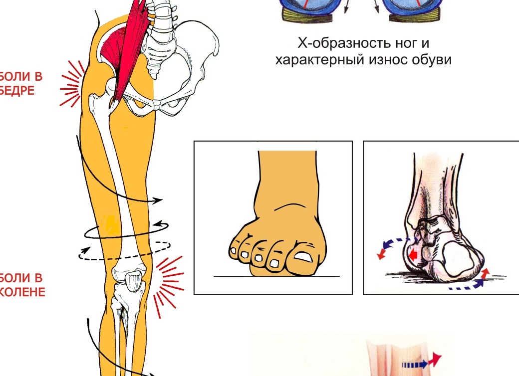 Почему от обуви болят ноги?